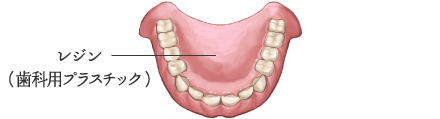 レジン（歯科用プラスチック）