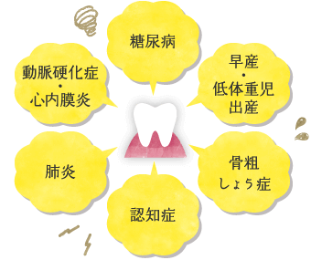 糖尿病・動脈硬化・心内膜炎・肺炎・認知症・骨粗しょう症・早産・低体重児出産